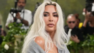 Kim Kardashian brain aneurysm